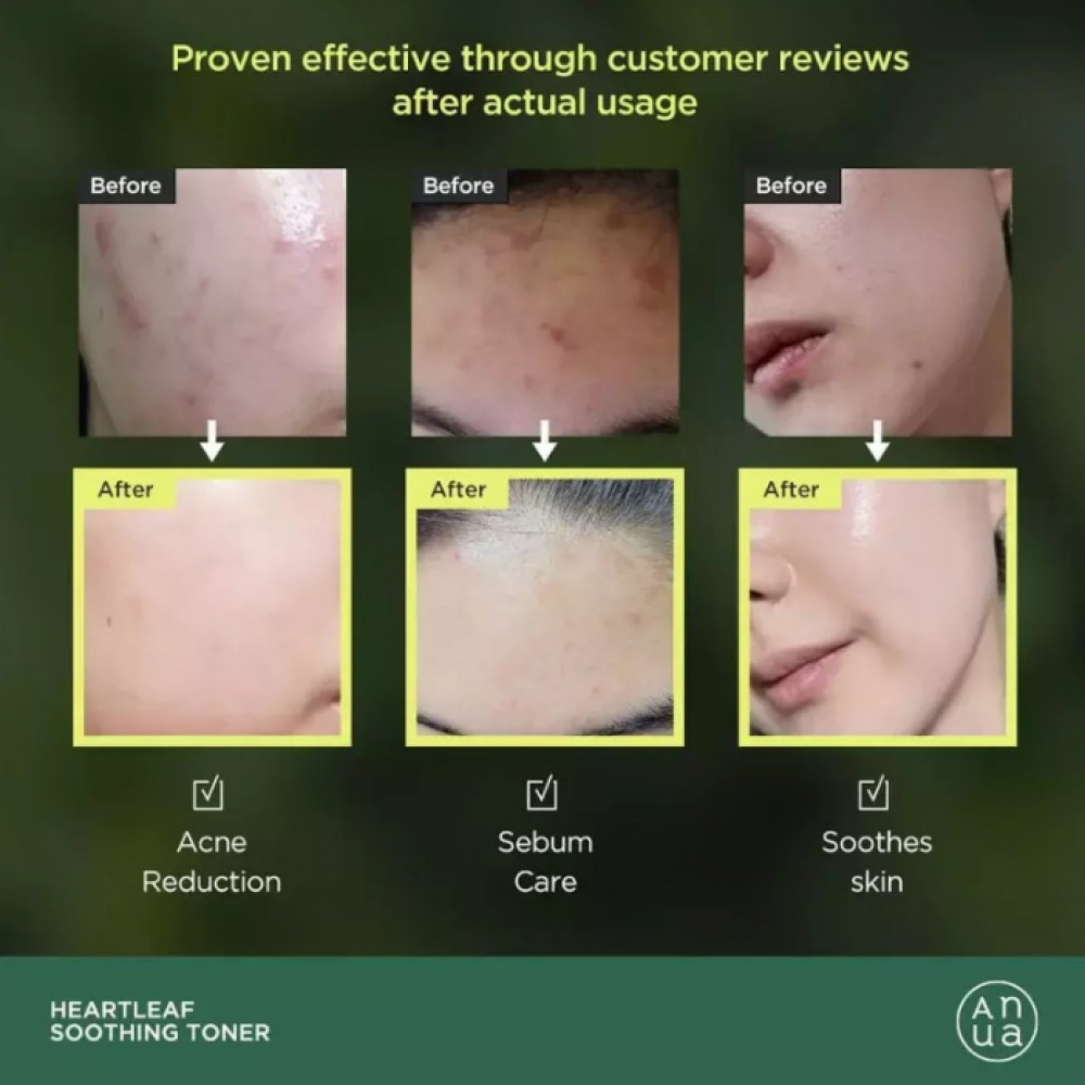 Anua Heartleaf 77% Soothing Toner 500ml SKINCARE