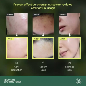 Anua Heartleaf 77% Soothing Toner 500ml SKINCARE