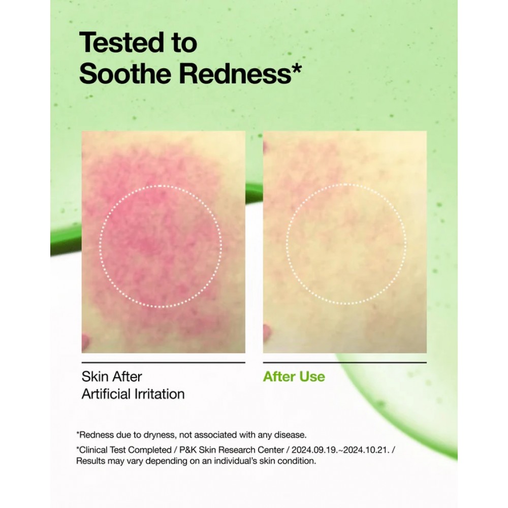 Anua Azelaic Acid 10 Hyaluron Soothing Serum 30ml SKINCARE