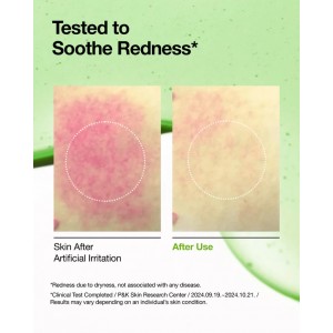 Anua Azelaic Acid 10 Hyaluron Soothing Serum 30ml SKINCARE