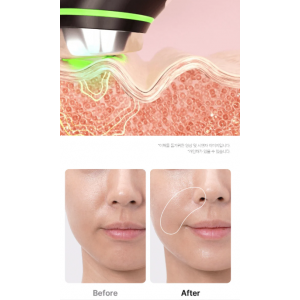 Medicube Age-r Booster Pro Black SKINCARE