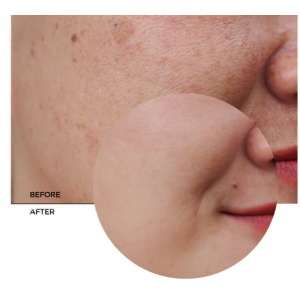 Revox B77 Skintreats Biotic Revitalising Radiance Cream Κρέμα προσώπου με υαλουρονικό οξύ και βιταμίνη C 50ml Περιποίηση Προσώπου