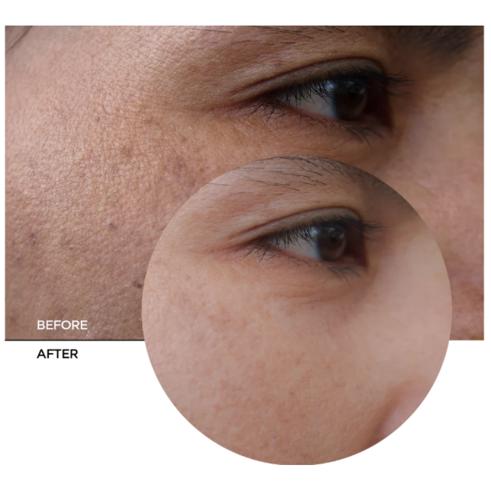 Revox B77 Skintreats Biotic Rehidrating Plumping Jelly Gel 50ml SKINCARE