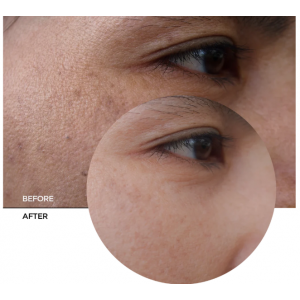 Revox B77 Skintreats Biotic Rehidrating Plumping Jelly Gel 50ml SKINCARE