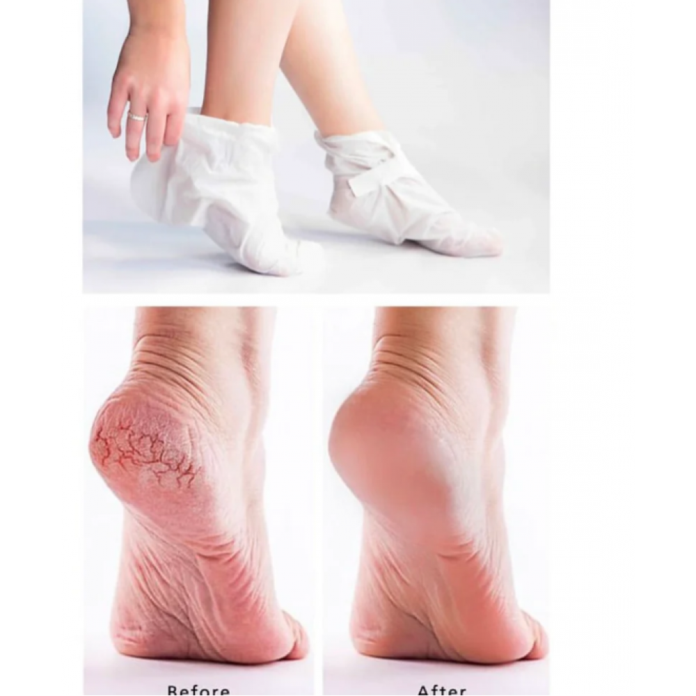 Farmstay Essential Foot Mask BODY CARE